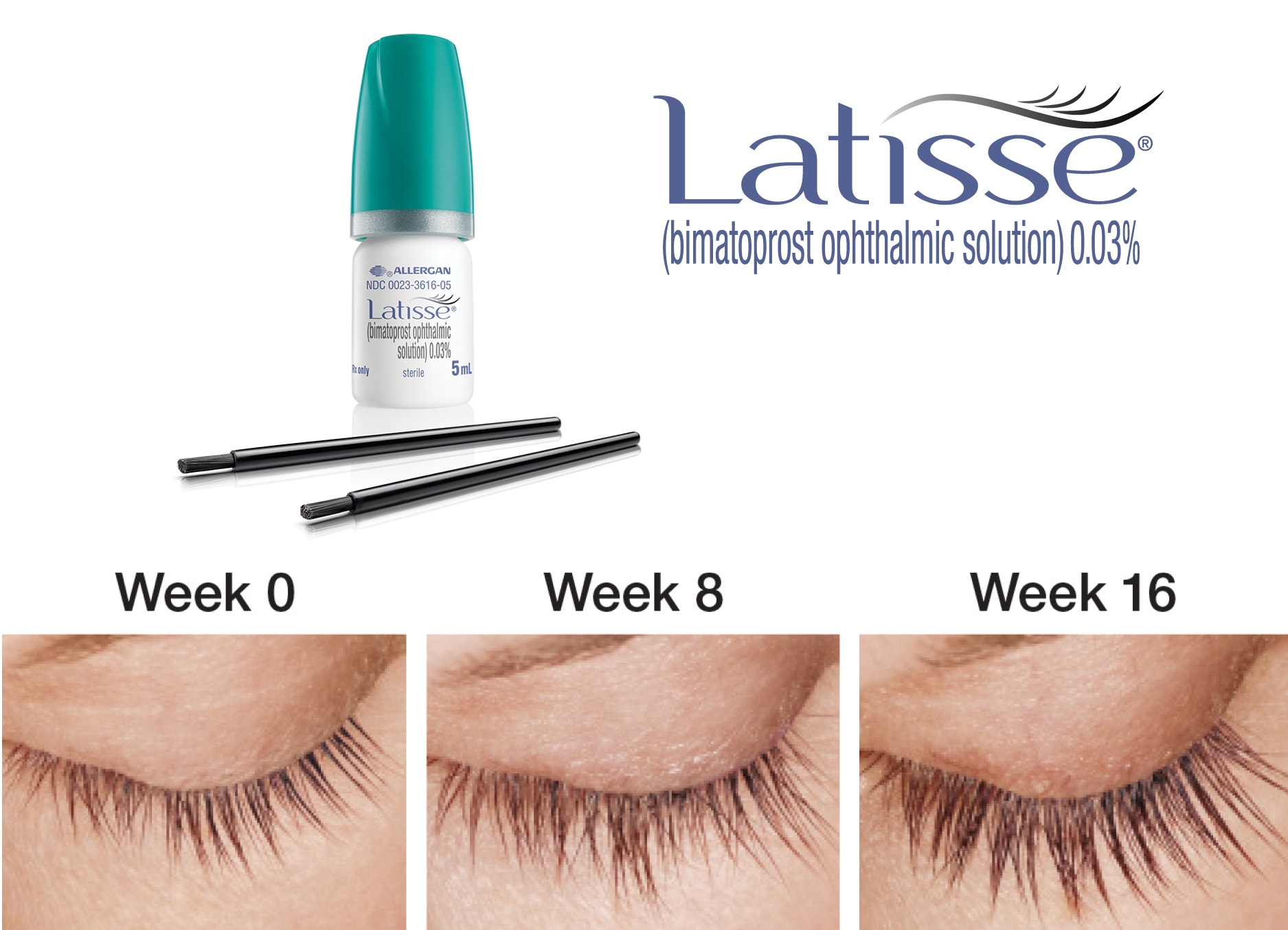 Latisse bimatoprost ophthalmic solution box and applicators
